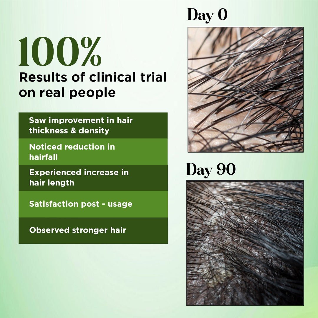 Rosemary Hair Oil (Added with 21 Powerful ingredients)