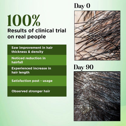 Rosemary Hair Oil (Added with 21 Powerful ingredients)